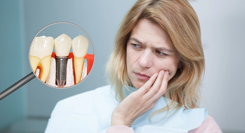 Cấy ghép implant nha khoa có đau không? Cách giảm đau hiệu quả.