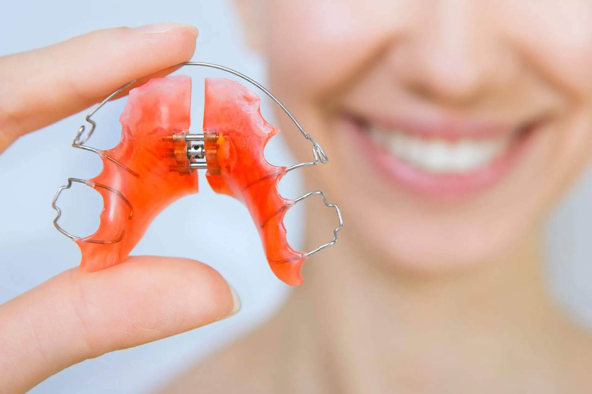 Hàm Duy Trì Trong Suốt Và Dây Duy Trì Cố Định: Loại Nào Tốt Hơn?